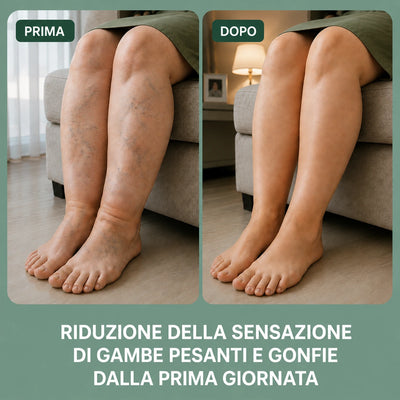 Prima e dopo: riduzione della sensazione di gambe pesanti e gonfie dalla prima giornata