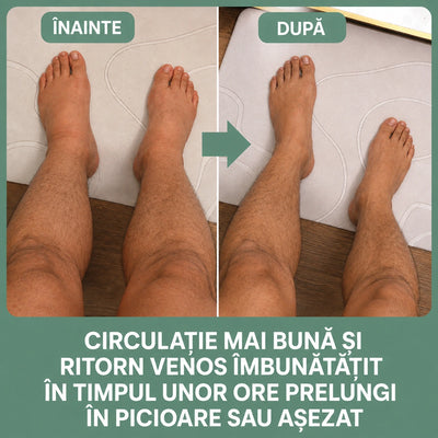 Înainte și după: circulație mai bună și ritorn venos îmbunătățit