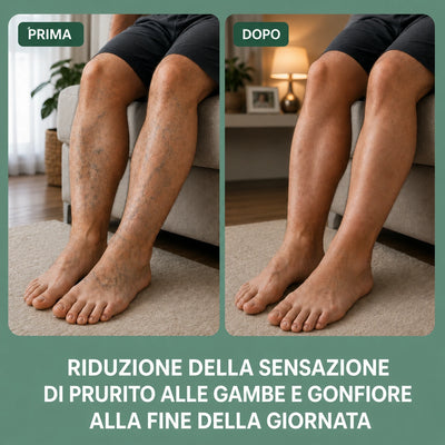 Prima e dopo: riduzione della sensazione di prurito alle gambe e del gonfiore a fine giornata